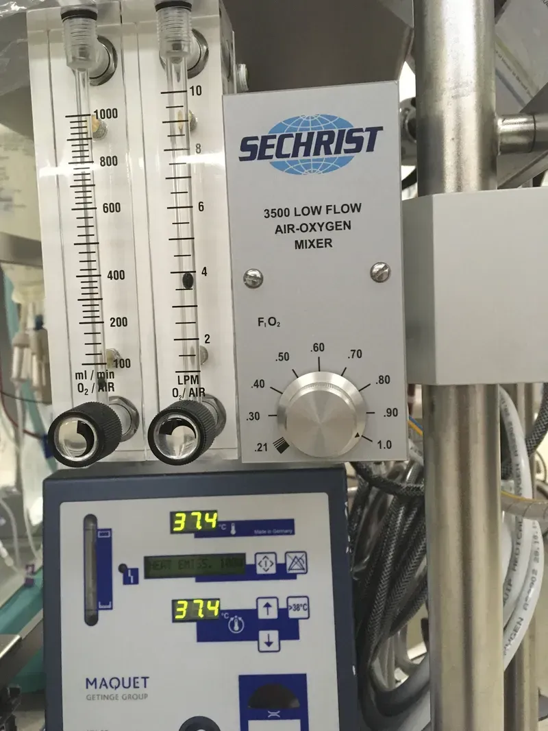 Internal view of an ECMO control board with visible components