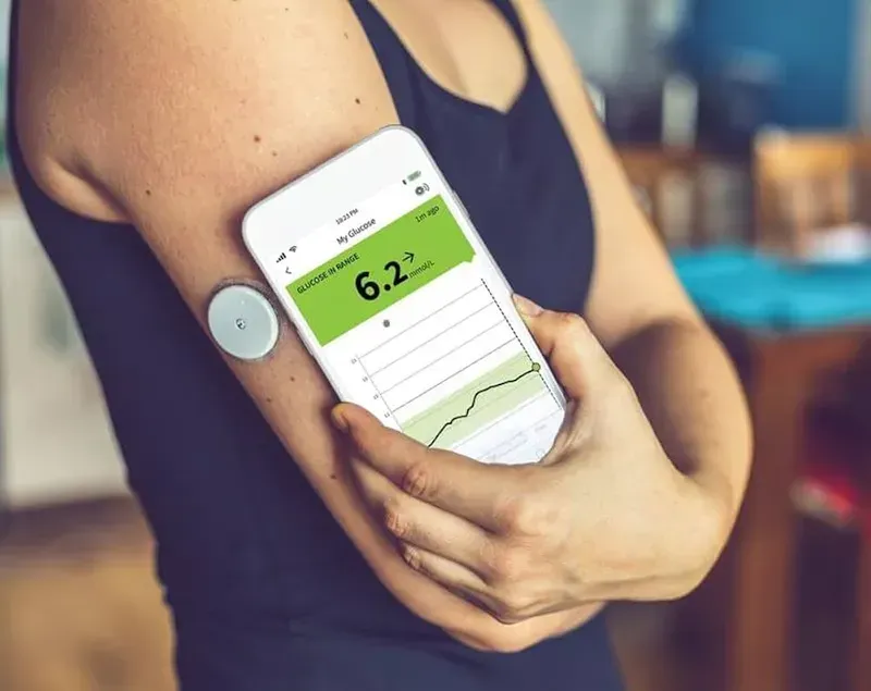 A smart blood glucose monitoring patch applied to skin