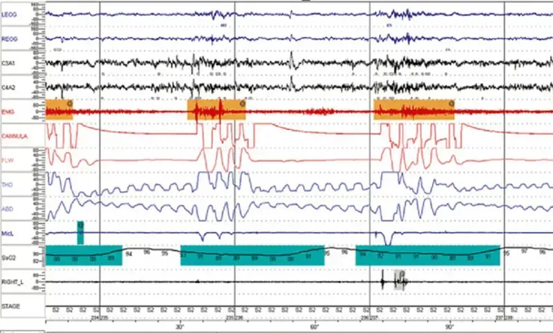 Testing the accuracy of sleep monitoring data